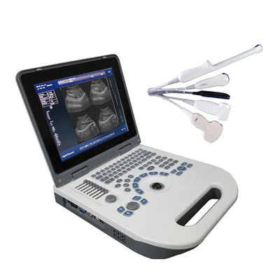 HBW-3 Metal Plus Full Digital Laptop B/W Ultrasound Machine